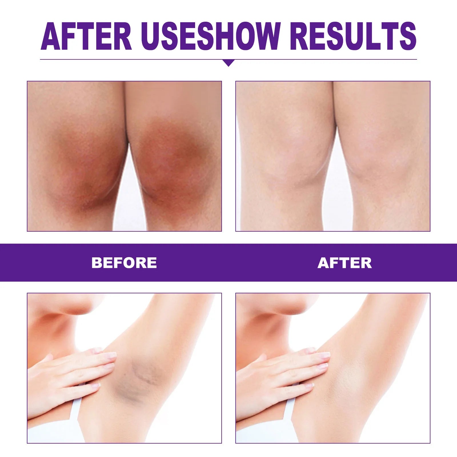 Women Skin Whitening Cream Remove Melanin Emulsion Brighten Inner Thigh Whiten Butt Knee Private Parts Underarm Bleaching Serum